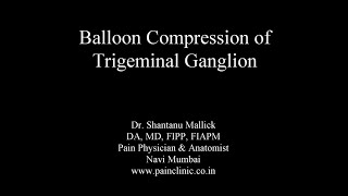 Balloon compression of Trigeminal Ganglion [upl. by Correy]