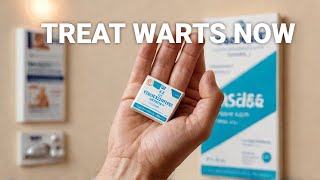 The Horrifying Types of Warts And How to Treat Them [upl. by Rettig]