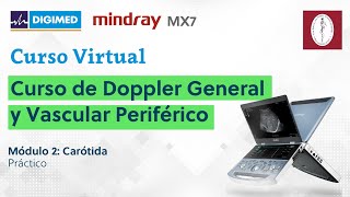 Curso de Doppler General y Vascular Periférico Módulo 2  Práctico Carótida [upl. by Yezdnil717]