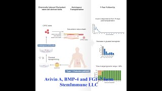 Breakthrough in Type 1 Diabetes Stem Cell Transplant Success [upl. by Eaner]