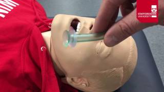 Nasopharyngeal Airway Insertion [upl. by Otrebron]