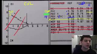 Spirometrie 2  valorile esentiale de urmarit pe o spirometrie [upl. by Naiviv]