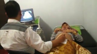 USG usia kandungan 27 minggu di Dokter La Royba Sindang Indramayu [upl. by Enomar]