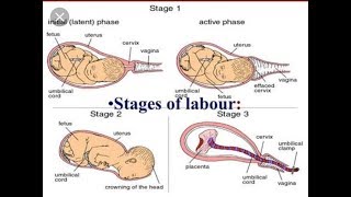 Stages of Labour [upl. by Lynde]