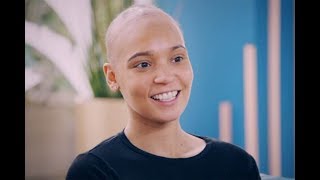 Body Fixers babe wakes up WITHOUT hair in tragic alopecia nightmare [upl. by Ful]