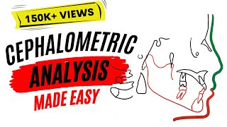 Cephalometric analysis [upl. by Tal743]