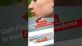 Solution for your closed comedones and mild acne pakistaniskincare indianskincare koreanskincare [upl. by Pinzler]