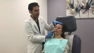 Kybella treatment for submental fat by Dr Patel [upl. by Ayot523]