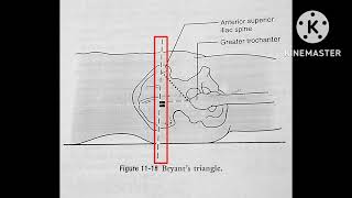 Bryants triangle  Hip joint special test [upl. by Steinman]