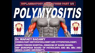 INFLAMMATORY MYOPATHIES PART II POLYMYOSITIS BY Dr WAFAEY BADAWY [upl. by Laius810]