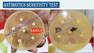 Antibiotics Sensitivity Test in Culture Media  Antibiotics Susceptibility Test in Bangla [upl. by Yrrek]