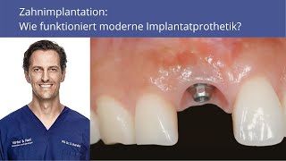 Zahnimplantation Wie funktioniert moderne Implantatprothetik [upl. by Riess]