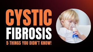 5 Facts You NEED to Know About Cystic Fibrosis [upl. by Whitcomb]