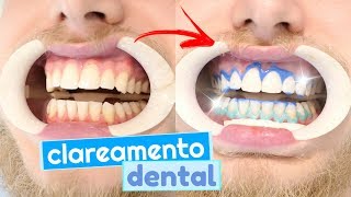 Tudo sobre meu clareamento dental dúvidas e como funciona clarear os dentes 😬💉 [upl. by Anitsihc]