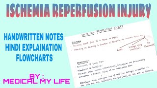 Ischemia Reperfusion Injury [upl. by Elleoj]