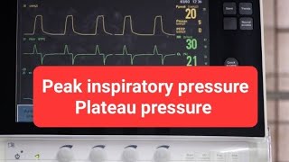 شرح Peak inspiratory pressure PIP and plateau pressure Pplat [upl. by Aitenev]