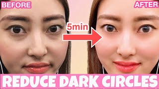 Reduce Dark Circles Wrinkles Under Eyes With This Massage [upl. by Xylina]