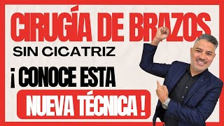 Operación o Cirugía de REDUCCIÓN DE BRAZOS SIN CICATRIZ ¡TODO LO QUE NECESITAS SABER Braquioplastia [upl. by Nessim]