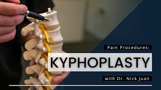 Kyphoplasty What You Need To Know [upl. by Averi]