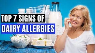 Top 7 Signs of a Dairy Allergy Signs of CMPA [upl. by Erodeht534]