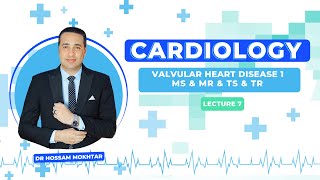 Cardiology  Valvular Heart Disease 1  MS amp MR amp TS amp TR [upl. by Yssim]