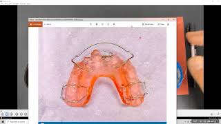 Orthodontic applience wire bending Z spring demo [upl. by Ardyth]