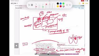 Pneumoconiosis Asbestosis Silicosis Berylliosis coal work Respiratory 42 First Aid USMLE Step1 [upl. by Kinzer]