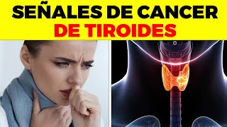 ASI EMPIEZA el Cáncer de Tiroides y nadie te lo dice signos y síntomas de cáncer de tiroides [upl. by Htiduy]