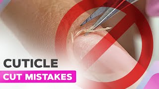 Donts When Cutting the Cuticle  Manicure Mistakes [upl. by Deenya]