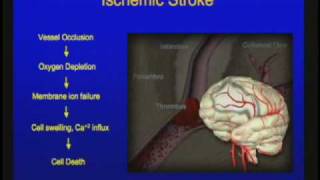 Vascular Disorders of the Central Nervous System [upl. by Emilie487]