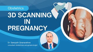 3D Scanning in Pregnancy  Dr Sampath Gnanarathne  KANDY VOG [upl. by Iznil]