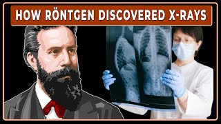 The Accidental Discovery That Changed Medicine  The Story of Xrays [upl. by Bonilla714]