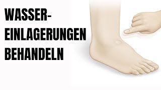 So behandelst du Wassereinlagerungen in den Beinen [upl. by Ikcin]