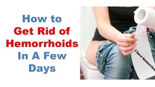 Best Hemorrhoids Treatment How To Get Rid Of Hemorrhoids Fast The Piles amp Hemorrhoid Cream I Used [upl. by Eirrek]