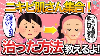 【必見！】ニキビ肌さん集合！ビックリするほど早く治ったみんなのスキンケア・改善法教えるよ！【肌荒れ美容ガルちゃんまとめ】 [upl. by Fidelis]