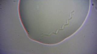 Incredible Footage Of Spirochete Bacteria 2500X [upl. by Nanci]