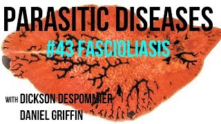 Parasitic Diseases Lectures 43 Fascioliasis [upl. by Rainer]