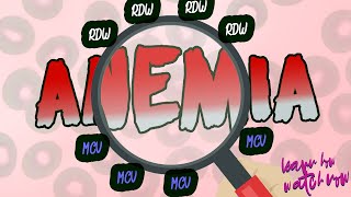 Classification of anemia by Red cell Distribution Width RDW and Mean Corpuscular Volume MCV [upl. by Mcintyre]