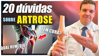 20 PRINCIPAIS DÚVIDAS SOBRE ARTROSE [upl. by Christis]