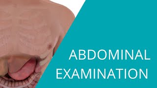 Abdominal Examination  Examination of the abdomen and gastrointestinal system [upl. by Nojed]