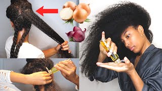 How To Properly Use Onion Oil For Massive Hair Growth [upl. by Euqitsym]