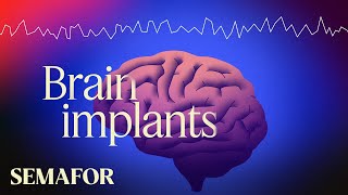 A major breakthrough in brain implants [upl. by Negris656]