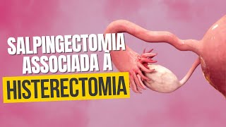 Histerectomia  4 Passos para Liberação da Cicatriz  aprenda como minimizar as sequelas da CICATRIZ [upl. by Ahsyia]