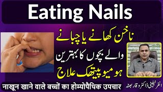 Eating Nails ناخن کھانا नाखून खाना and Its Homeopathic Treatment by Dr Waqar Bhutta in Urdu  Hindi [upl. by Hyrup861]