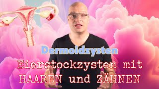 Eierstockzysten mit Haaren und Zähnen  Dermoidzysten [upl. by Kcirddes269]