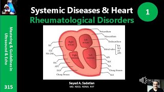 Systemic Diseases amp Heart 1 Rheumatological Disorders [upl. by Ahsieket]