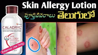 Caladryl Skin Soothing Solution  Review In Telugu l All Kinds Of Skin Allergies [upl. by Ahseinek]