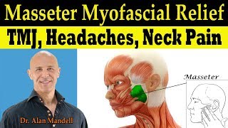 Masseter Myofascial Relief for TMJ Headaches Neck Pain Tinnitis Dizziness  Dr Alan Mandell DC [upl. by Waters]