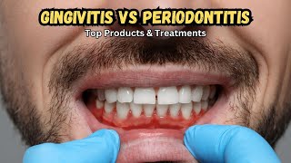 🦷 Gingivitis vs Periodontitis Top Treatments amp Best Products Revealed 🪥 [upl. by Hadwyn512]