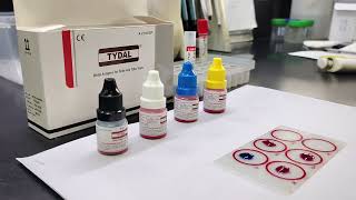 How to do WIDAL Test  Benifits of WIDAL tests  Test for Typhoid widaltest labtest [upl. by Etnud]